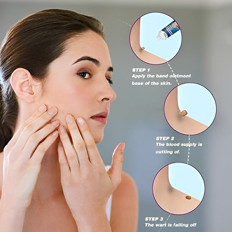 🌿 Crema Eliminadora de Verrugas y Mezquinos